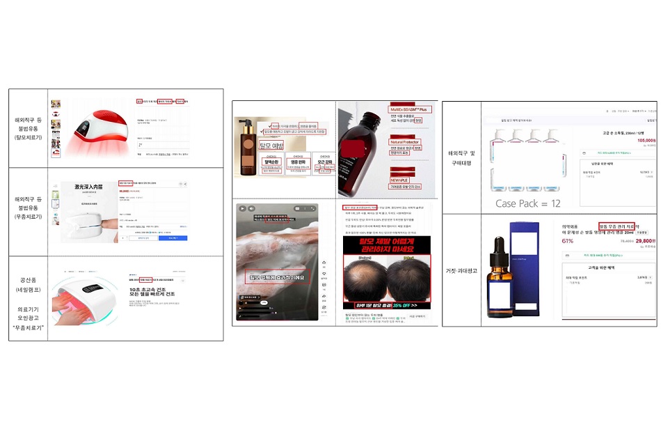 탈모치료 효과 표방한 온라인 부당광고 376건 적발